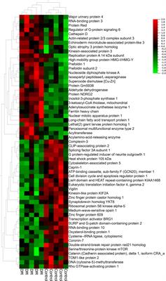 Proteomic analysis of diabetic retinas